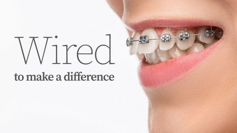 Cosmetic Dentist in Dubai | Kings Dental Center