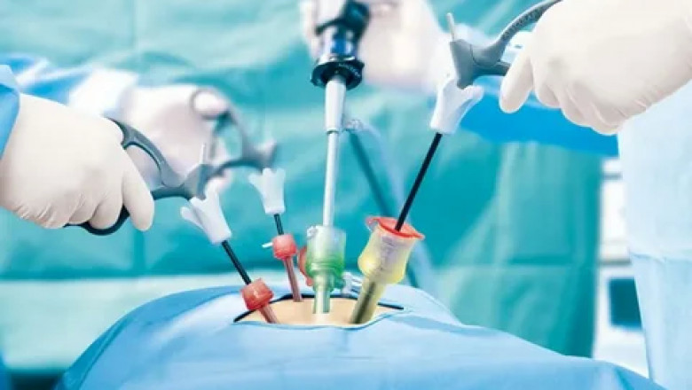 Minimally Invasive Surgery is implanted through minor