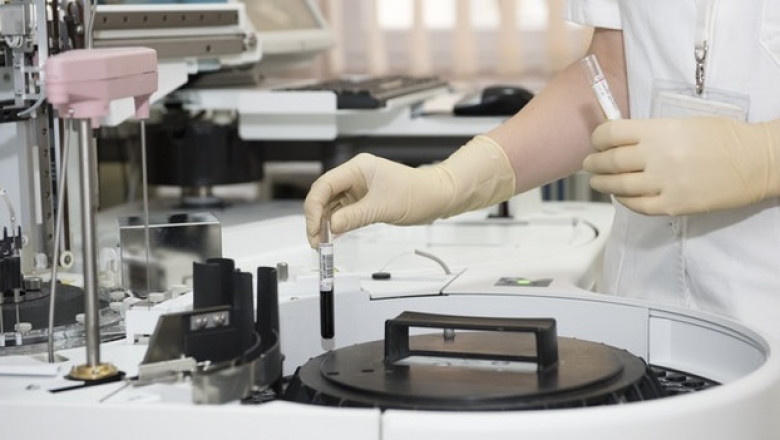 Esoteric Testing Market: Business Growth, Share, and CAGR of ~12% during 2022 – 2031