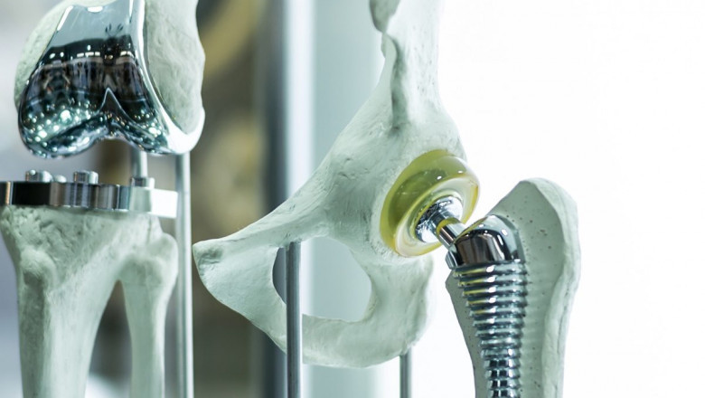 Orthopedic Biomaterials Market: Size Analysis By Growth, CAGR of ~9%, and Forecast To 2030