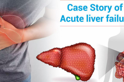 Acute liver failure - Dr. Pathik Parikh
