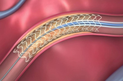 Global Coronary Artery Disease Therapeutics Market Opportunities