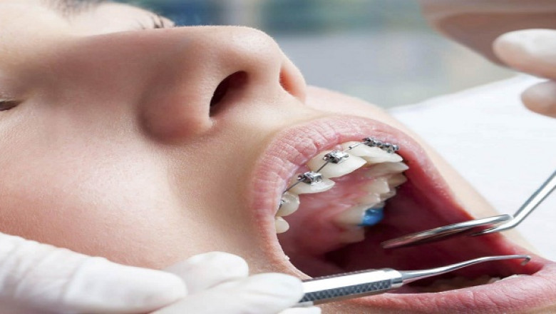 miami orthodontist