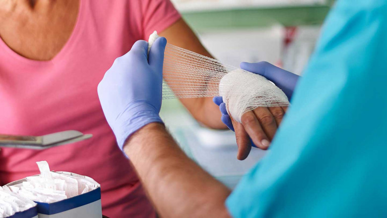 Wound Care Biologics Market: Global Trends, Size, Share, Growth, Opportunity, and Forecast through 2025