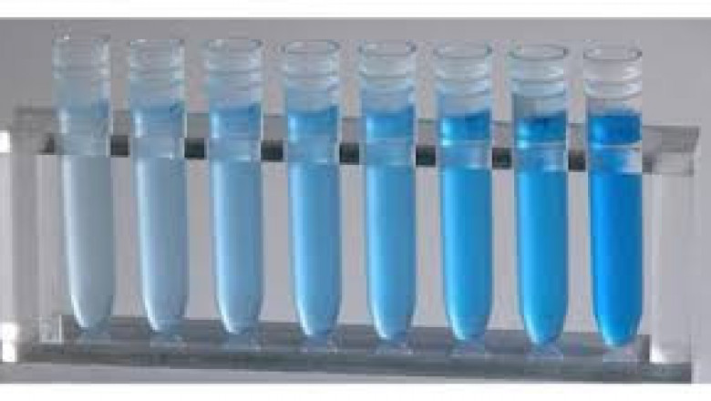 Amino Acid Assay Kits Market 2022 Size, Key Players & Forecast Report to 2028