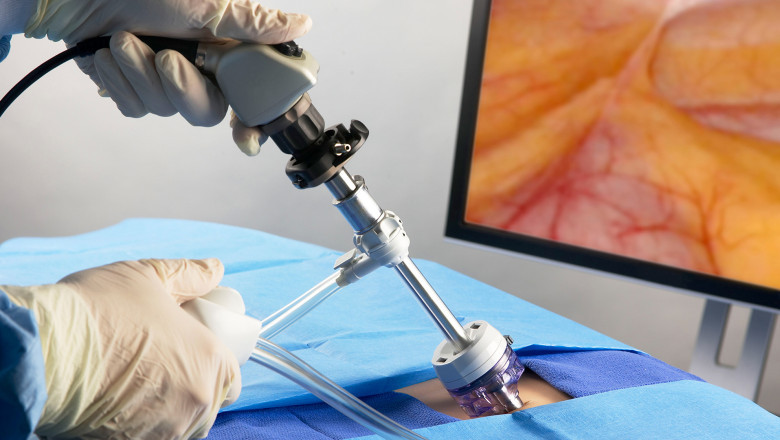 Approaches of Spine Surgery Devices during the Surgical Process