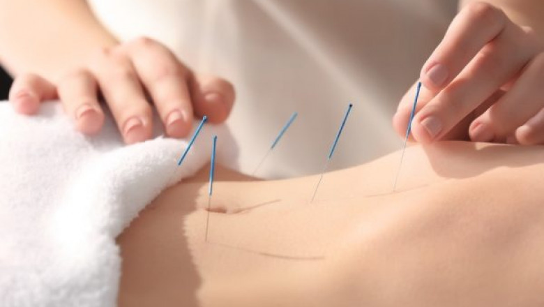 Fertility Support - Nutritional modifications in male infertility