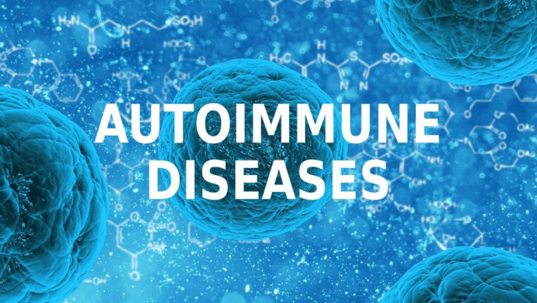Global Autoimmune Treatment Market Report, Latest Trends, Industry Opportunity & Forecast to 2028
