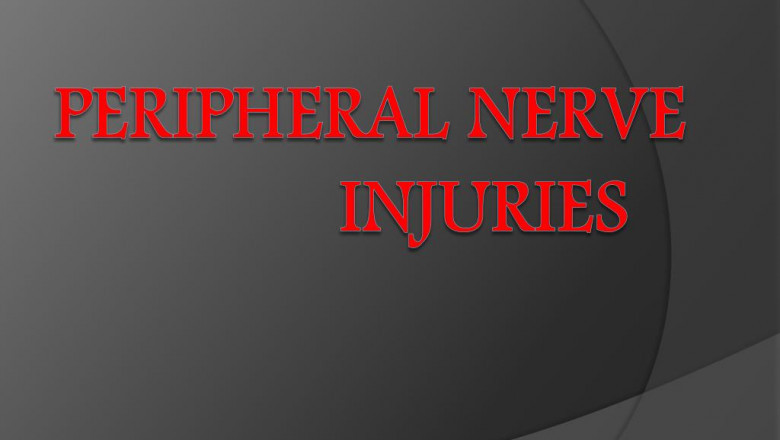 Global Peripheral Nerve Injuries Market Report, Latest Trends, Industry Opportunity & Forecast to 2028