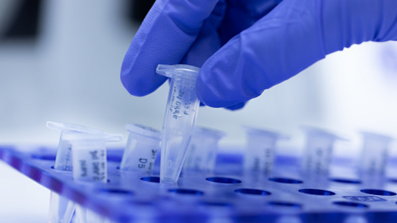 Companion Diagnostics Market Predicted to Witness Surge in The Near Future