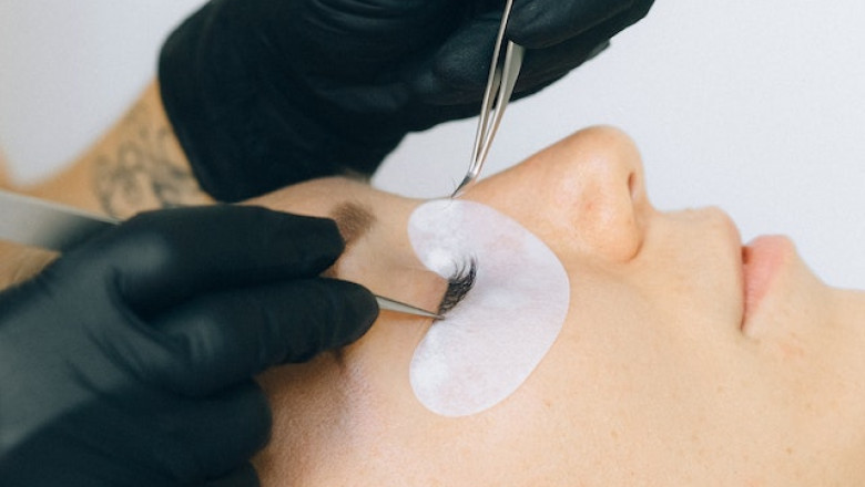 How Expensive is Cosmetic Surgery in Agra