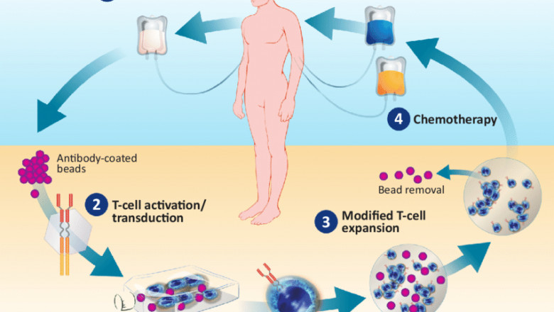CAR-T cell therapies Market Research Methodology, Competitive Analysis and Estimation Forecast by 2028