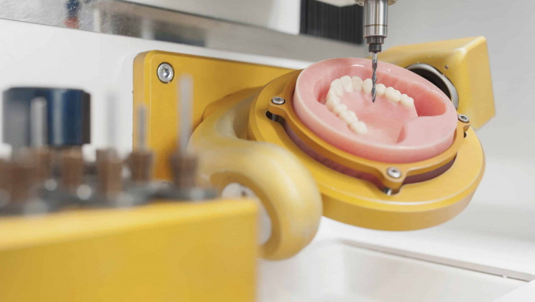 Dental CAD/CAM devices are an excellent advancement in dentistry