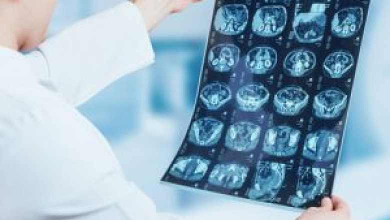 Companion Diagnostics Market Opportunities, Production Cost Analysis, Market Development and Market Dynamics Forces