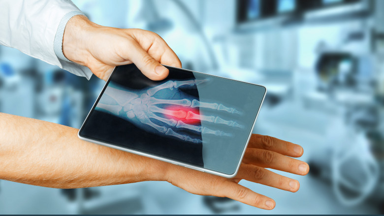 Doctors Use Smart Medical Devices To Track The Vital Physiological Signs Of Many Illnesses