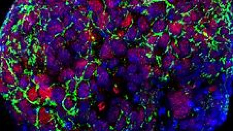 Whole Exome Sequencing Market Analysis | Recent COVID-19 Impact and Industry Trends Report, 2028