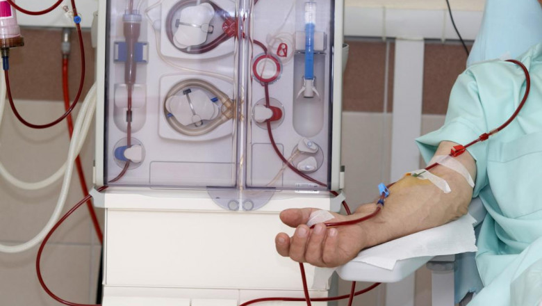 Dialysis Market to Experience Significant Growth by 2030