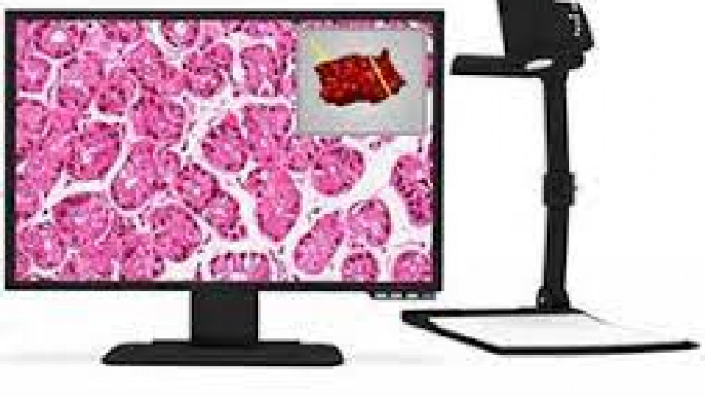 Report on Macroscopic Imaging Systems Market Research 2028 - Value Market Research