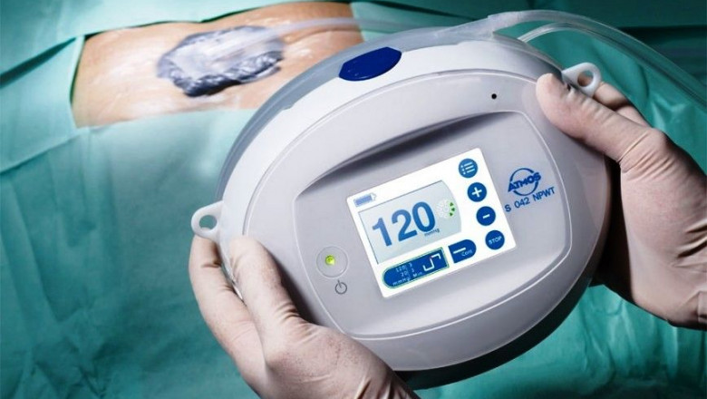 What are the Negative Pressure Wound Therapy (NPWT) Devices?