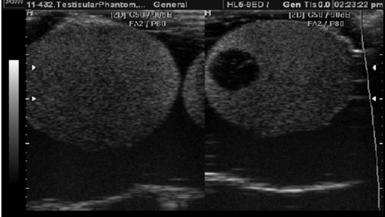 5 Most Pervasive Benefits of Scrotum Ultrasound