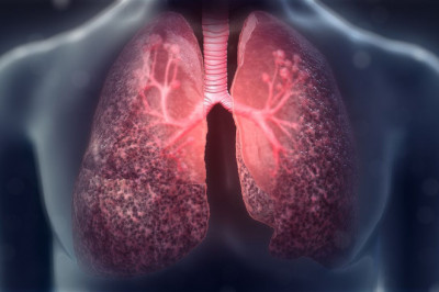 Global Cystic Fibrosis Market Outlook