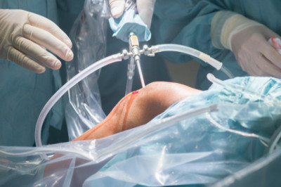 Knee Replacement Surgeon in Utah