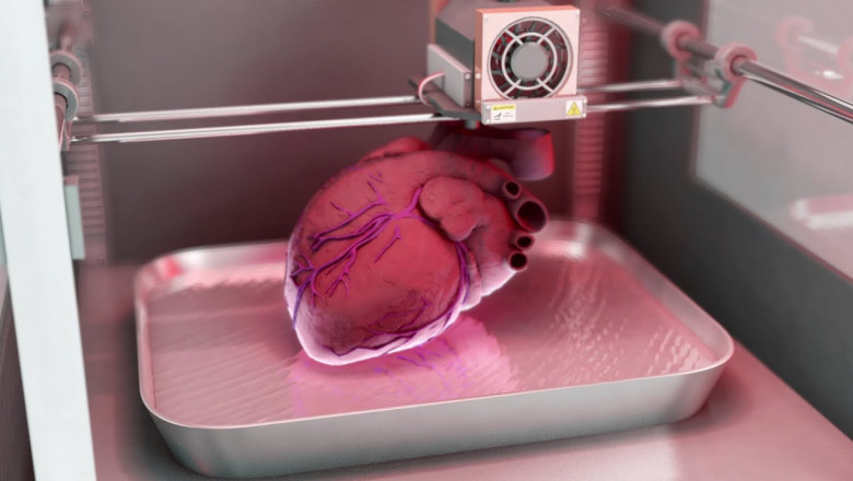 3D Printed Medical Devices manufacturing has increased dramatically