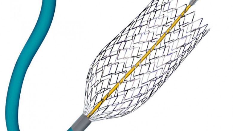 Devices used in Interventional Cardiology Devices are used to repair damaged heart valves