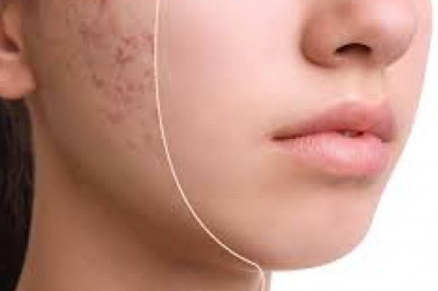 Global Glycolic Acid Market 2022 - Top Key Players Analysis Report Till 2028