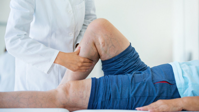 Global Varicose Vein Treatment Market Restraints