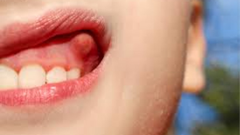 What Are the Key Benefits of Seeing an Emergency Dentist?