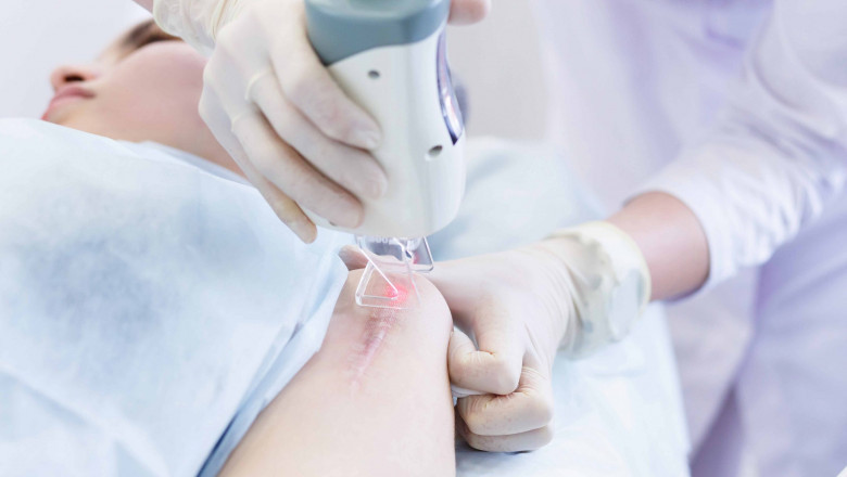 When Selecting A Post-Surgical Scar Treatment Product