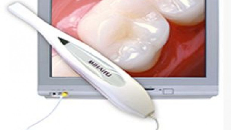 What to Know About Zoom Teeth Whitening?