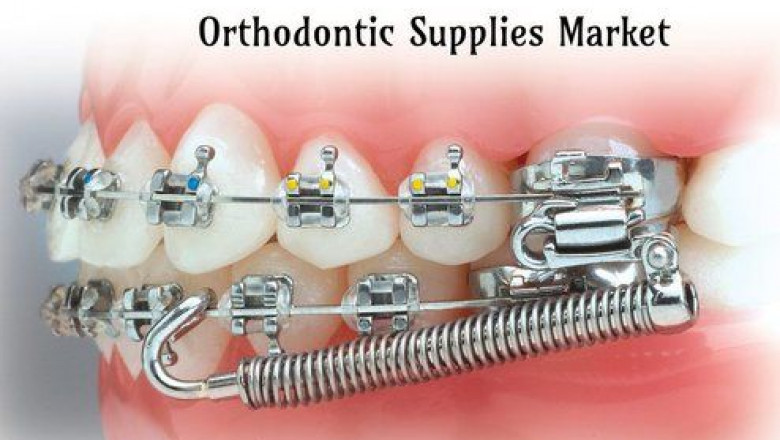 Orthodontic Consumables Market | Global Industry Trends, Segmentation, Business Opportunities & Forecast To 2028