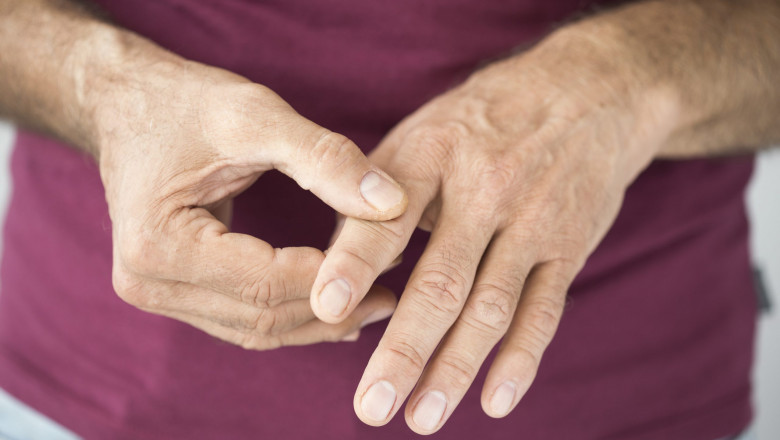 What is Rheumatoid Arthritis Treatment?