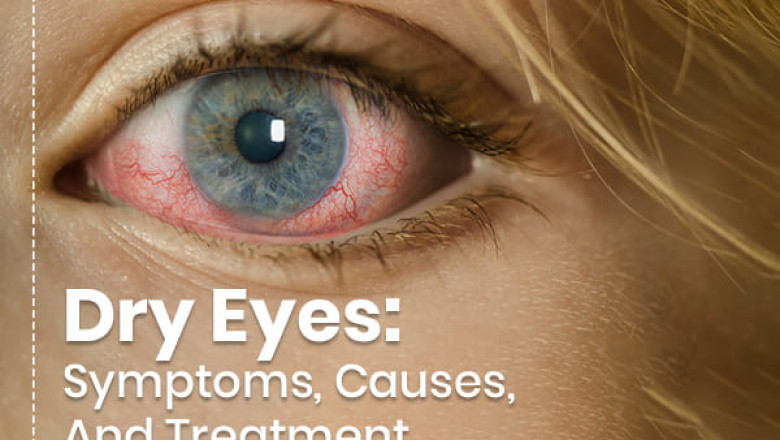 Dry Eye Syndrome Treatment Market 2022 | Industry Demand, Fastest Growth, Opportunities Analysis and Forecast To 2028