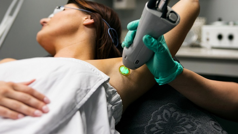 Laser Hair Removal Melbourne