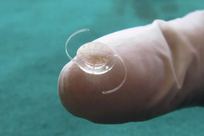 Recent Development in Massive Intraocular Lenses Market 2029 Booming Worldwide