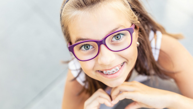 Braces - Conveniently Acquiring A Great Smile