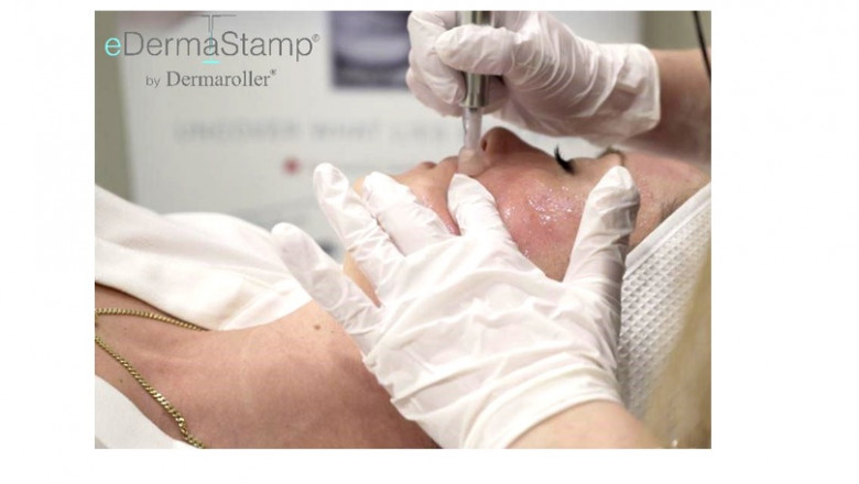 Getting Professional Skin Care is Important!