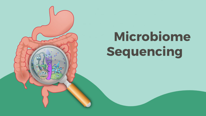 Microbiome Sequencing Services Market Size, Status, Growth | Industry Analysis Report 2022-2028