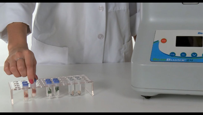 Global Cell Lysis Market Analysis
