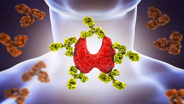 Symptoms And Autoimmune Disease Treatment: Autoimmune Disease Occurs When One's Own Immune System Damages Healthy Body Tissue