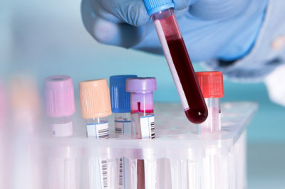 Blood Screening Is An Effective Method Of Preventing Infection Before Blood Donation