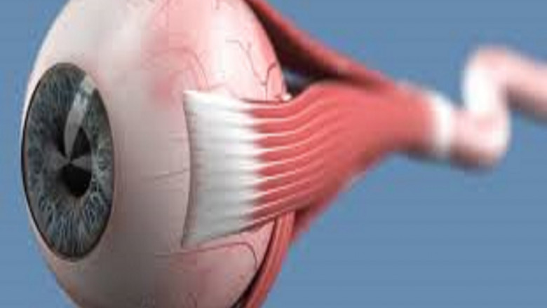 Global Optic Neuritis Treatment Market Report, Latest Trends, Industry Opportunity & Forecast to 2028