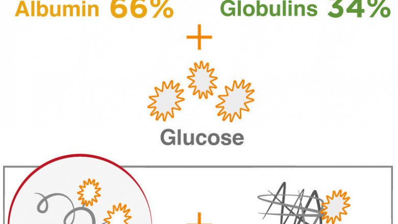 In Diabetic Patients Who Fail To Get Sufficient Control Of Hba1c With Hbga, Glycated Albumin Assay Is Used As A Biomarker To Monitor Blood Glucose Levels