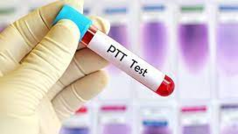 Activated Partial Thromboplastin Test Market Size, Share, Growth, Opportunities and Global Forecast to 2028