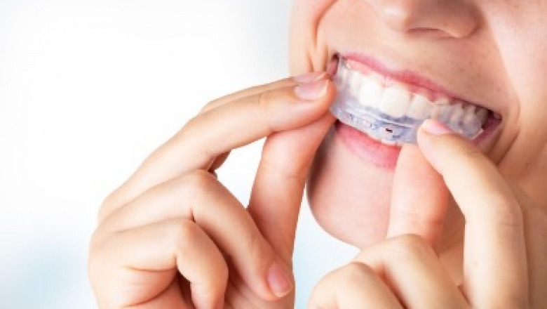 Five Interesting Things to Consider Before Getting Dental Implants