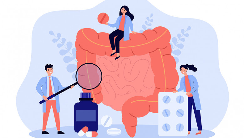 Global Colorectal Cancer Therapeutic Market Report, Latest Trends, Industry Opportunity & Forecast to 2028