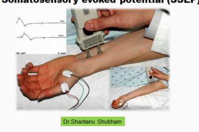 Somatosensory evoked potential (SSEP) - Dr.Shantanu Shubham